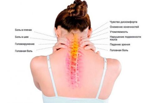 Лечение болевых синдромов нижнешейного отдела позвоночника (Фидель Субботин)