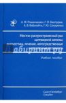 Местно-распространенный рак щитовидной железы. Диагностика, лечение / Романчишен Анатолий Филиппович, Вабалайте Кристина Викторовна, Багатурия Георгий Отарович, Сокуренко Герман Юрьевич