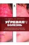 Угревая болезнь. Комбинированная лазерная и фотодинамическая терапия / Картелишев Анатолий Васильевич, Демина О. М.