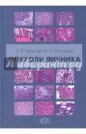 Опухоли яичника / Нейштадт Эдуард Львович, Ожиганова Ирина Николаевна