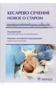 Кесарево сечение. Новое о старом. Иллюстрированное практическое руководство / Ренцо Джан Карло Ди, Мальвази Антонио, Антонелли Кьяра