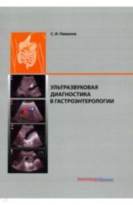 Ультразвуковая диагностика в гастроэнтерологии / Пиманов Сергей Иванович