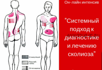 Системный подход к лечению сколиоза (Игорь Атрощенко)