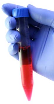 Пробирка коническая 10 мл, 17х121 мм, п/п, нестерил., с град-кой., с винт.,крышкой, M.Med, 100 шт/упак