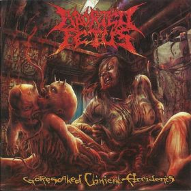 ABORTED FETUS - Goresoaked Clinical Accidents